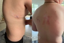 выкса.рф, В Выксе возбуждено уголовное дело после нападения собаки на ребёнка