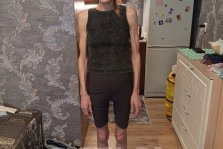 выкса.рф, В Выксе объявлен сбор средств на лечение Ольги Цыпляевой