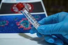 выкса.рф, У 13 выксунцев нашли коронавирус