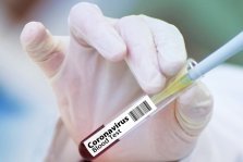 выкса.рф, Более 30 выксунцев заразились коронавирусом